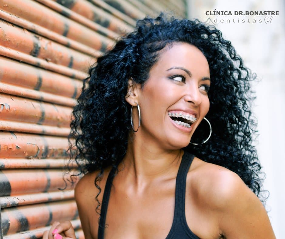 Ortodoncia fija (Brackets) Tu solución para una sonrisa perfecta