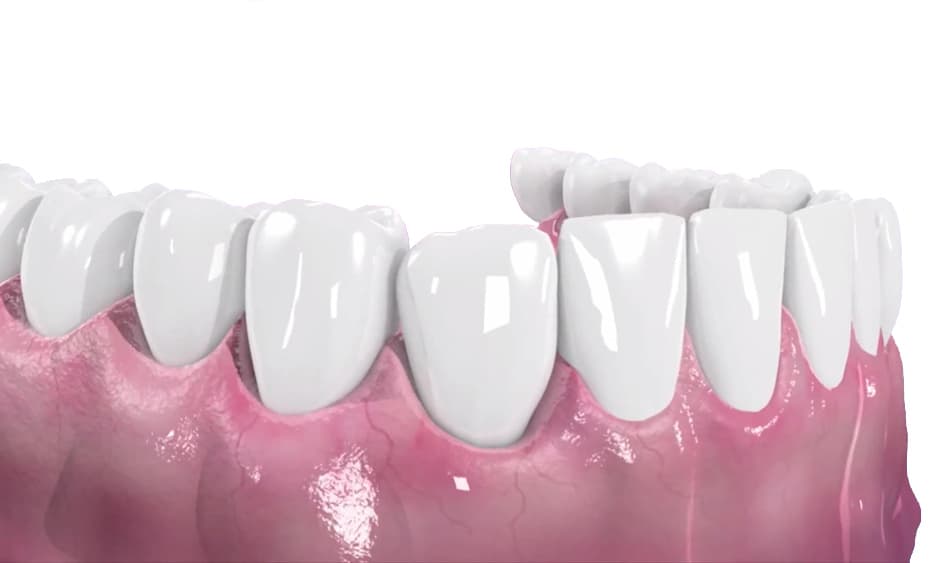 Periodoncia