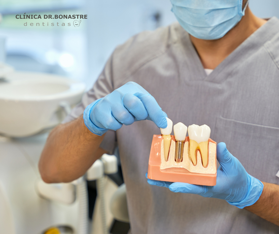 Implantología dental: la solución definitiva para la pérdida de dientes