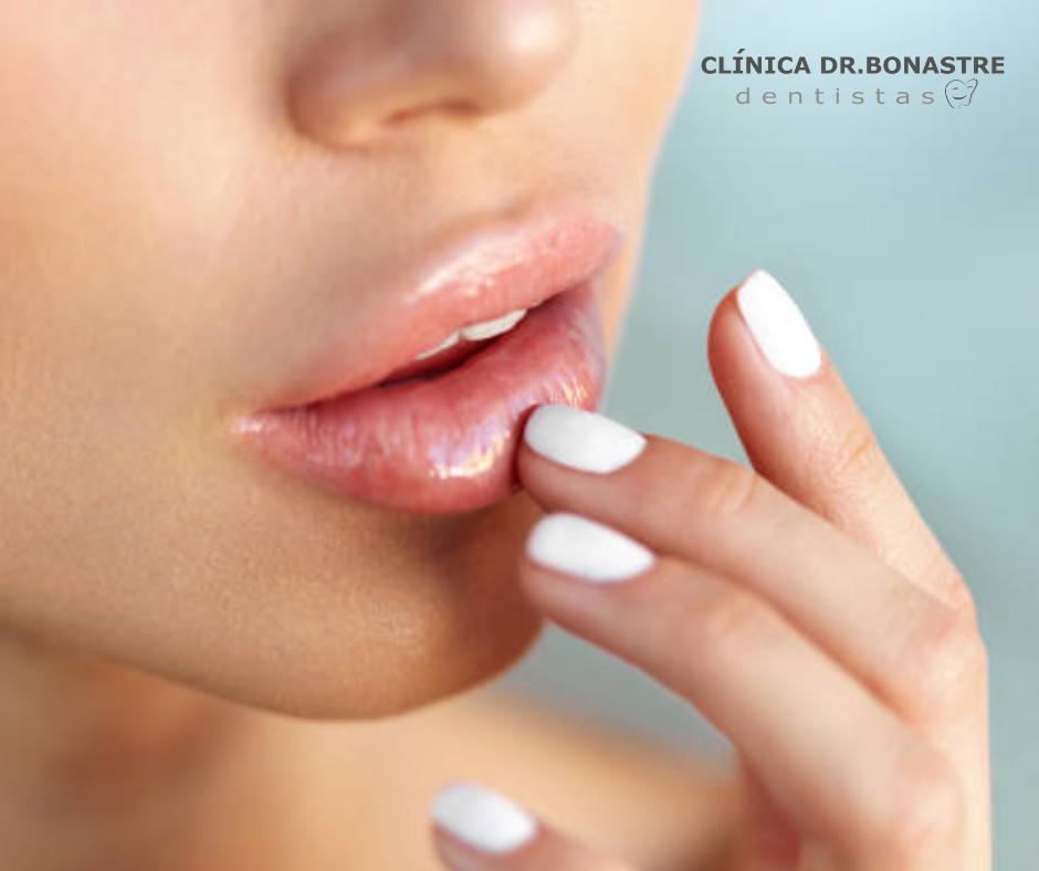 Aumento-de-labios-con-acido-hialuronico-Descubre-el-tratamiento-estetico-mas-demandado